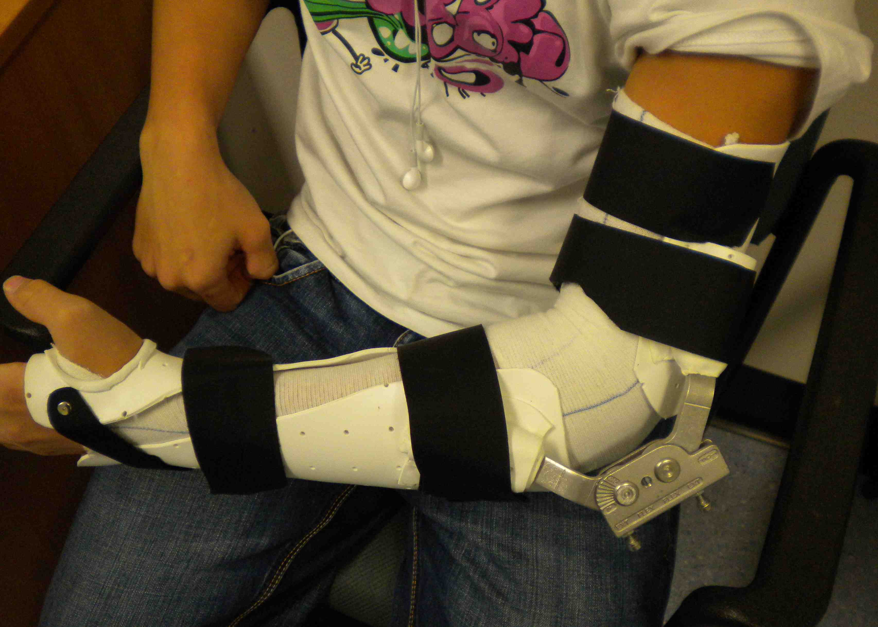 Elbow ROM Brace